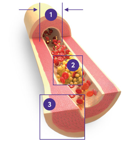 Orenitram mechanism of action