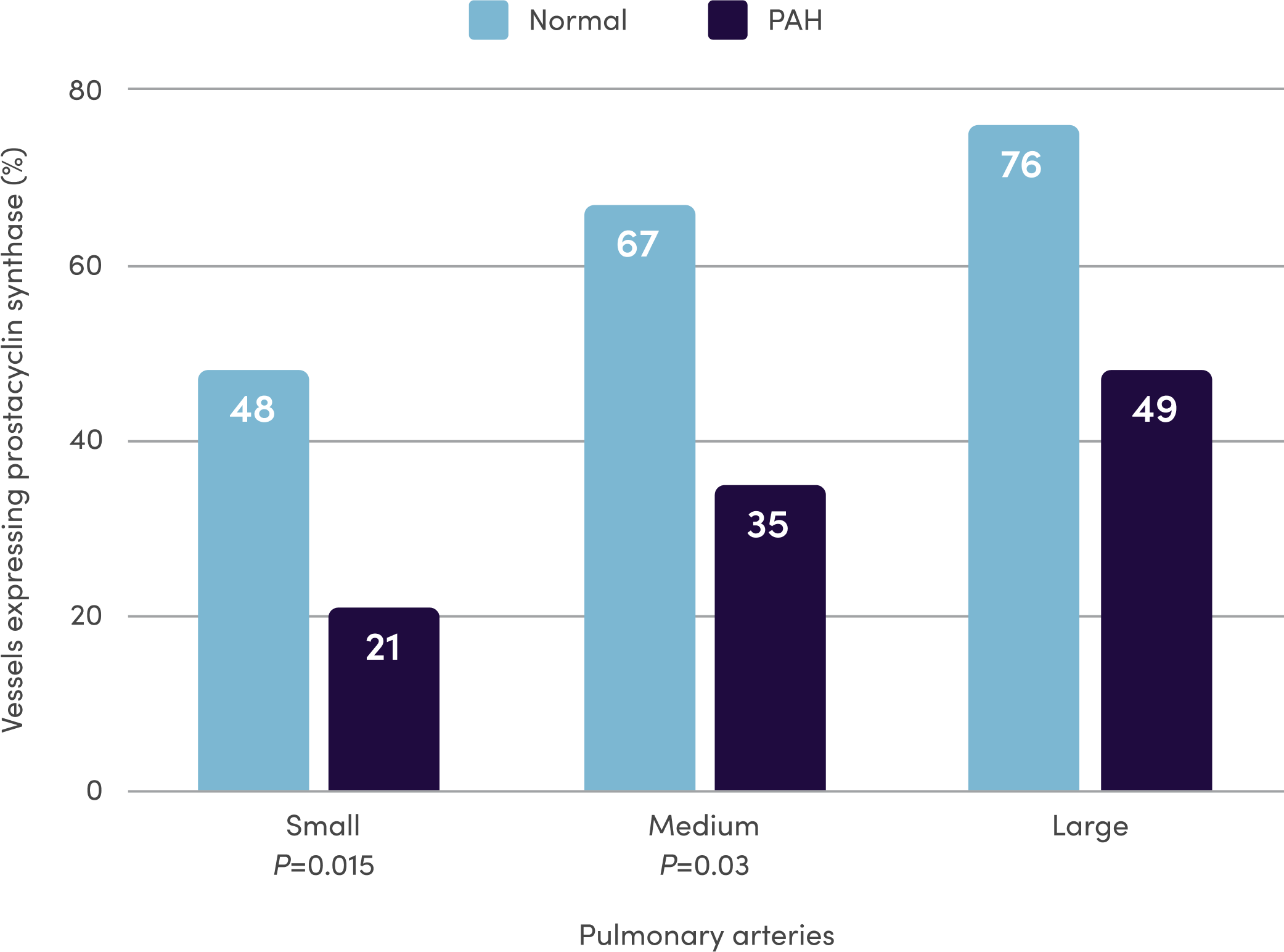 Chart showing the potential lack of prostacyclin in patients with PAH